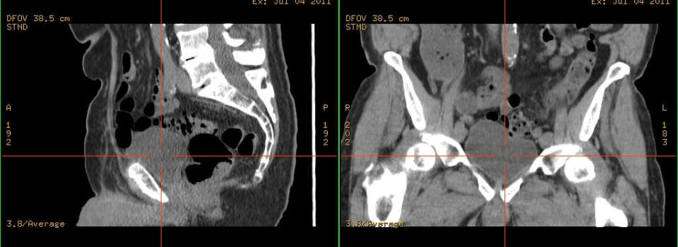 Symbilbild für einen CT-Scan.